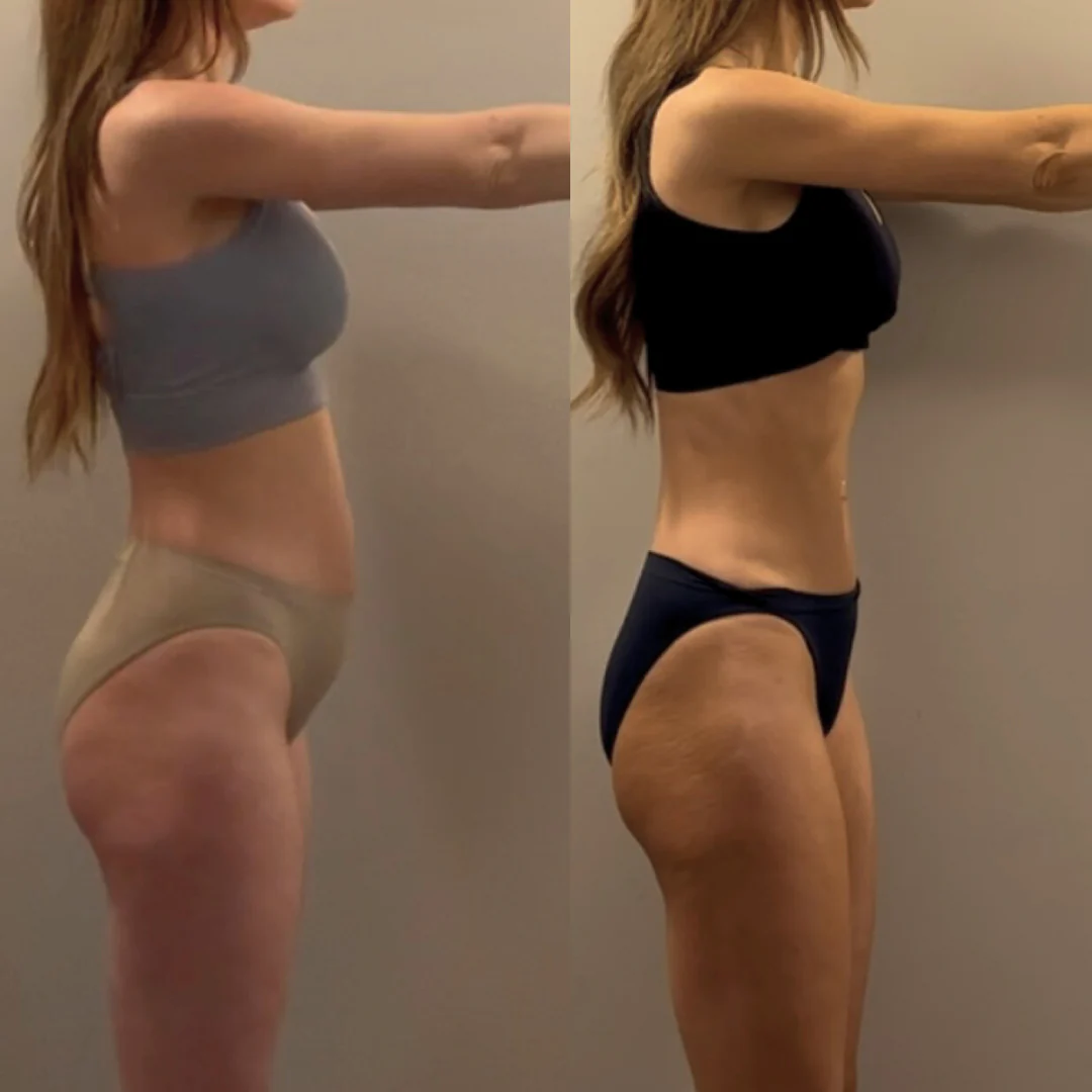 Before and after transformation